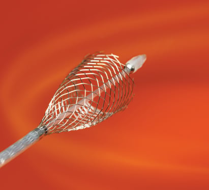 Study Finds Wide Variation in Carotid Artery Stenting Outcomes | DAIC